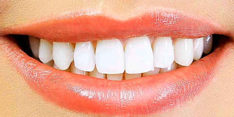 Teeth Whitening – an Incredible Look That’s Effective and Safe